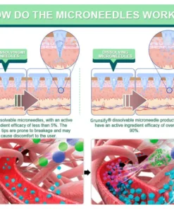 Cougex® NIDDK-Tirzepatide Nano Patch
