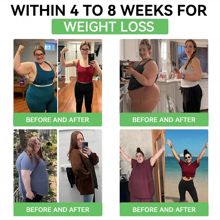 CrazyLeafยฎ GL๐-1 6-๐๐-1 ๐ฏ๐๐๐๐๐ ๐บ๐๐๐๐๐๐๐ ๐ฎ๐๐บ๐
๐๐ข๐ช๐ฎ๐ข๐