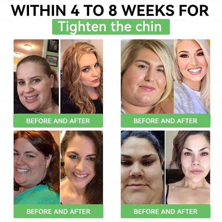 CrazyLeafยฎ GL๐-1 6-๐๐-1 ๐ฏ๐๐๐๐๐ ๐บ๐๐๐๐๐๐๐ ๐ฎ๐๐บ๐
๐๐ข๐ช๐ฎ๐ข๐