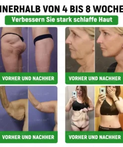 CrazyLeafยฎ GL๐-1 6-๐๐-1 ๐ฏ๐๐๐๐๐ ๐บ๐๐๐๐๐๐๐ ๐ฎ๐๐บ๐
๐๐ข๐ช๐ฎ๐ข๐