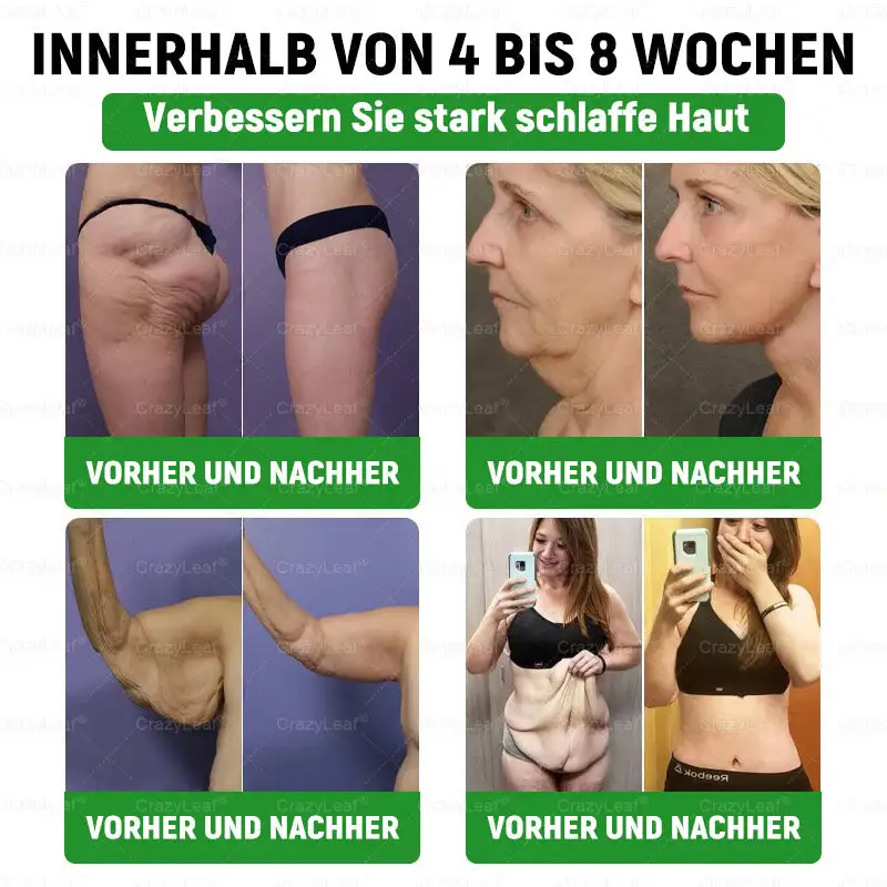 CrazyLeafยฎ GL๐-1 6-๐๐-1 ๐ฏ๐๐๐๐๐ ๐บ๐๐๐๐๐๐๐ ๐ฎ๐๐บ๐
๐๐ข๐ช๐ฎ๐ข๐