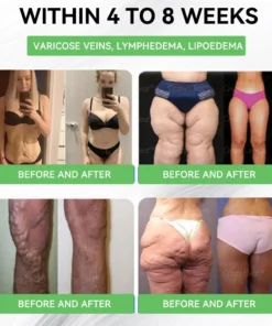 CrazyLeafยฎ GL๐-1 6-๐๐-1 ๐ฏ๐๐๐๐๐ ๐บ๐๐๐๐๐๐๐ ๐ฎ๐๐บ๐
๐๐ข๐ช๐ฎ๐ข๐