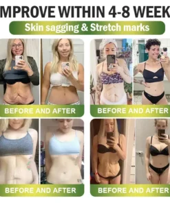 CrazyLeaf® SMGT-GLP-1 Nano Microneedle Patch