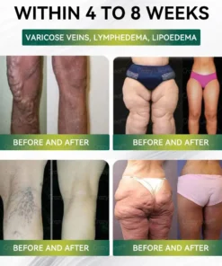 CrazyLeaf® SMGT-GLP-1 Nano Microneedle Patch