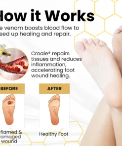 Croaie® Bee Venom Diabetic Foot Ulcer Spray