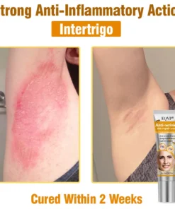 EQVP® Anti-wrinkle skin repair cream