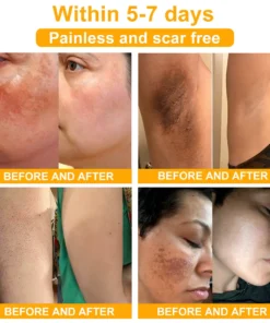 EQVP® Anti-wrinkle skin repair cream