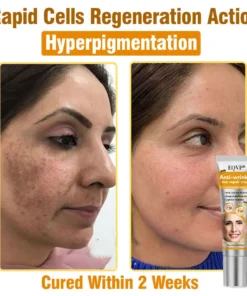 EQVP® Anti-wrinkle skin repair cream