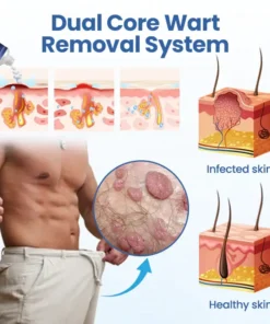 Femica® GentX WartRelief Cream