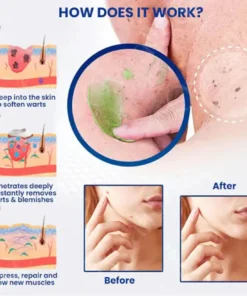 Femica™ NatureErase Instant Mole & Spot Cream