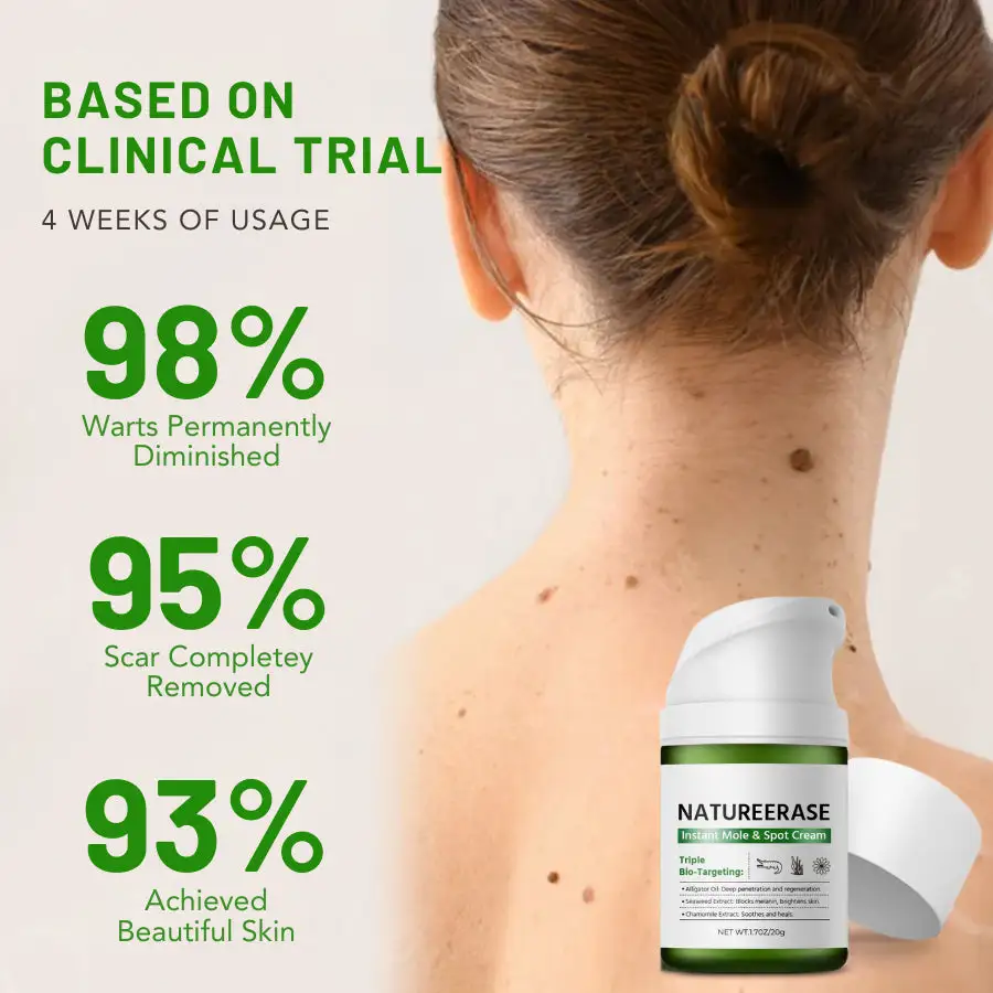 Femica™ NatureErase Instant Mole & Spot Cream