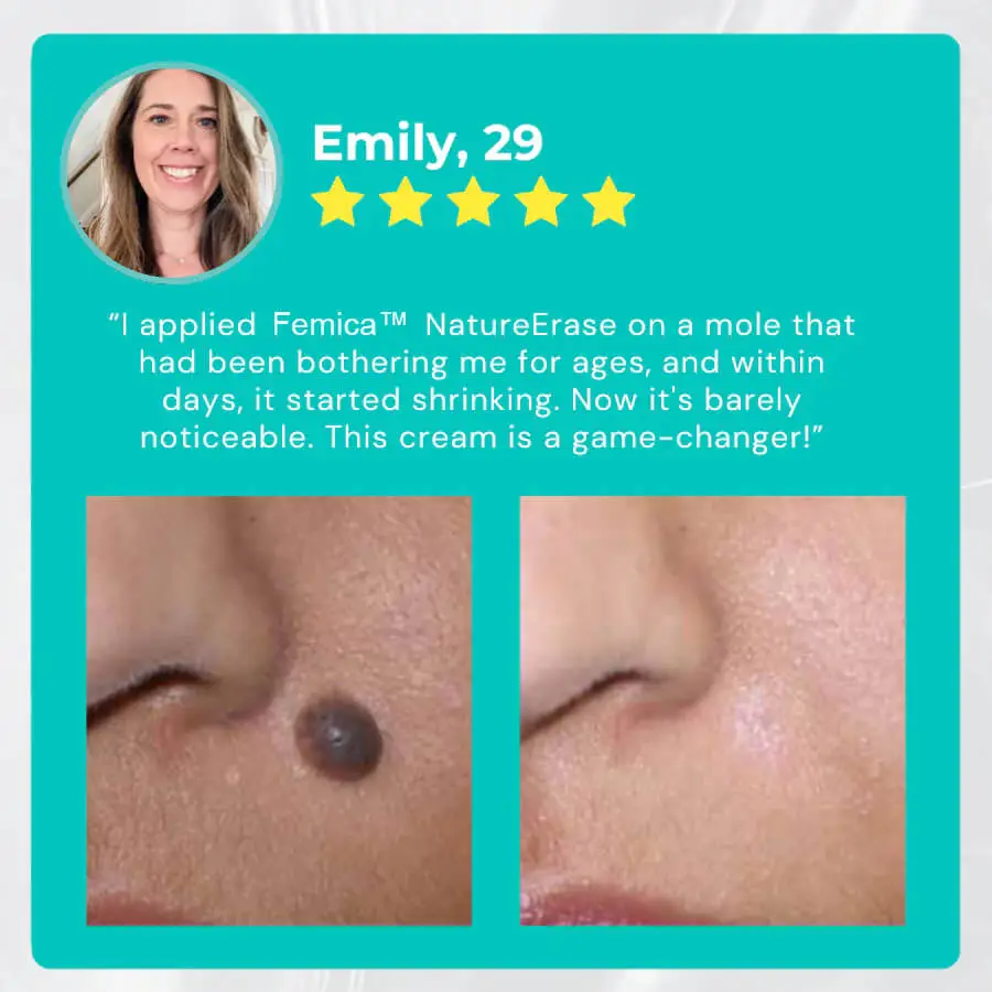 Femica™ NatureErase Instant Mole & Spot Cream