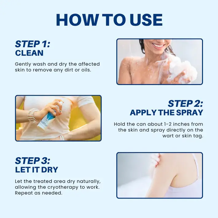 Femica® TagRecede Cryo Treatment Spray