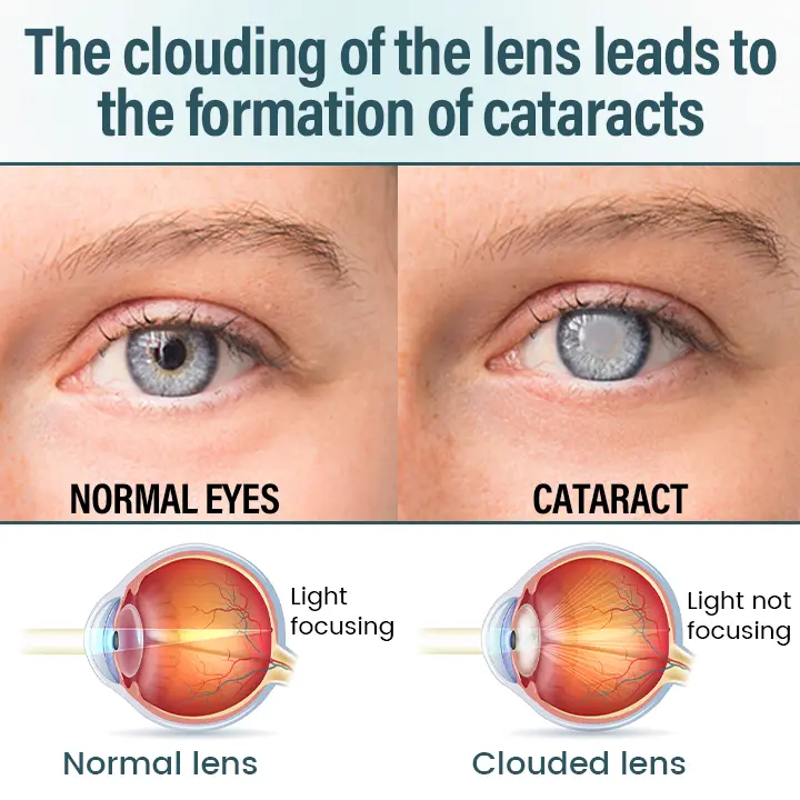 HZA® OptiFusion Nano Eye Drops Serum