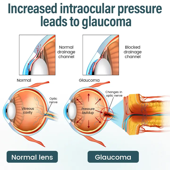 HZA® OptiFusion Nano Eye Drops Serum