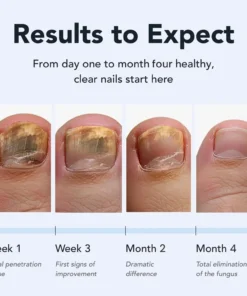 Juxek™ Pro Nail Repair Pen – 25% Undecylenic Acid