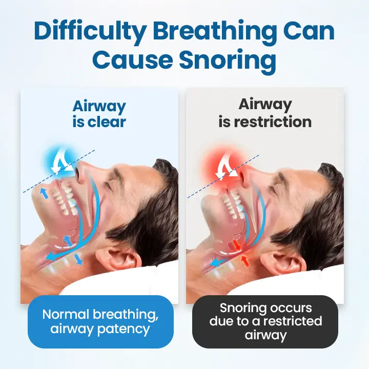 Juxek® SnoreLess Nasal Breather