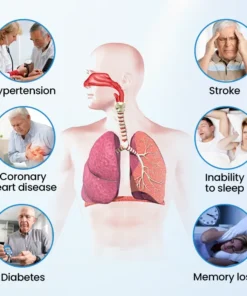 Juxek® SnoreLess Nasal Breather