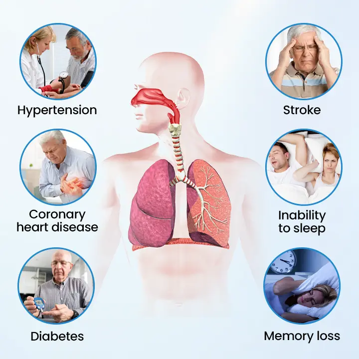Juxek® SnoreLess Nasal Breather