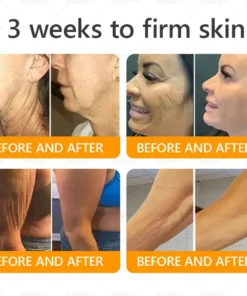 LBMLBM™ Bee venom Comprehensive Cream