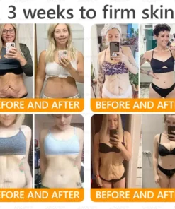 LBMLBM™ Bee venom Comprehensive Cream