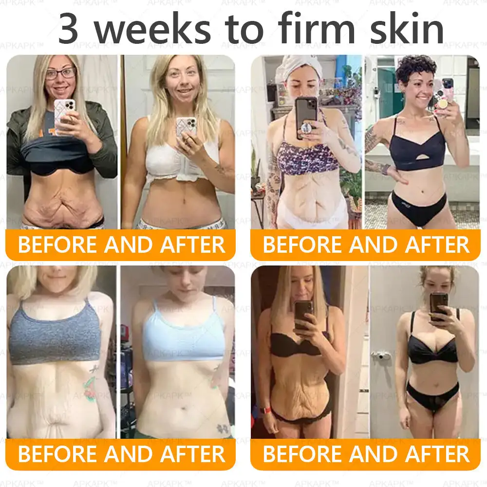 LBMLBM™ Bee venom Comprehensive Cream