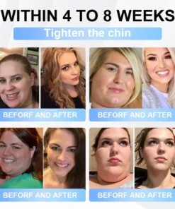 LBMLBM® Tirzepatide Slimming & Health Nano Microneedle Patch