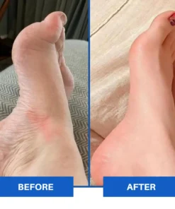 Medinity™ Advanced EMS Foot Massager