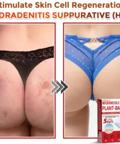 Newyuo® MicroNeedle Botanic Skin Tag Removal Patch