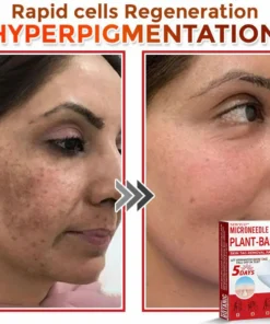 Newyuo® MicroNeedle Botanic Skin Tag Removal Patch