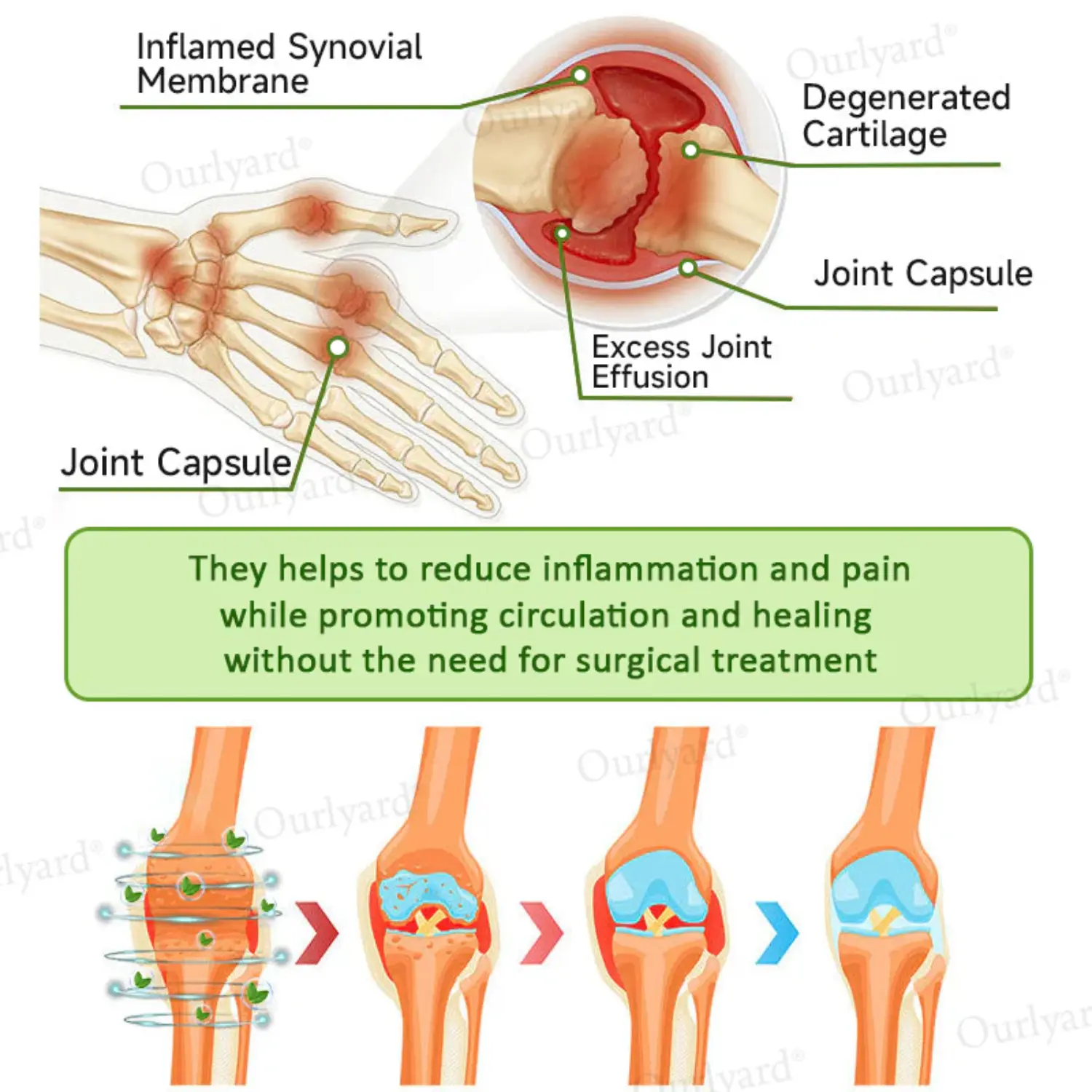 NovaRX® Magnesium & Peppermint Arthritis Pain Relief and Bone Healing Cream