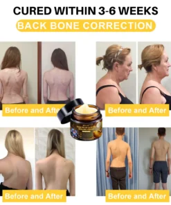 NovaRX® Pain Relief & Bone Healing Cream with Bee Venom