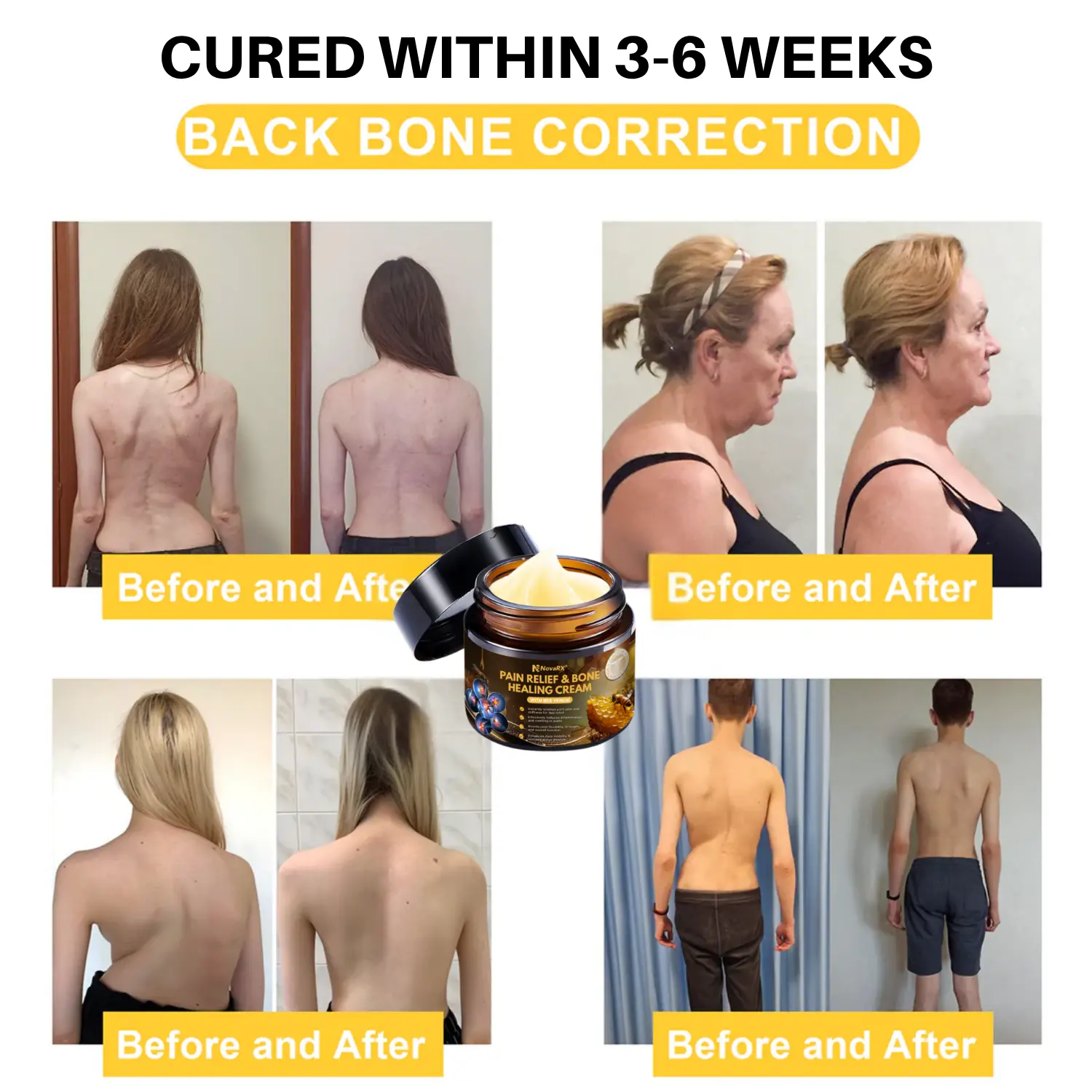 NovaRX® Pain Relief & Bone Healing Cream with Bee Venom