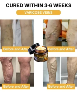 NovaRX® Pain Relief & Bone Healing Cream with Bee Venom