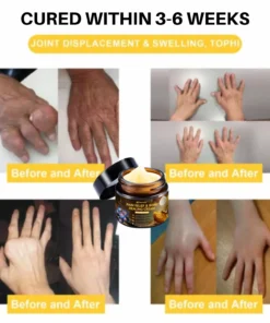 NovaRX® Pain Relief & Bone Healing Cream with Bee Venom