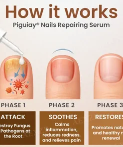 Piguiay® Nails Repairing Serum