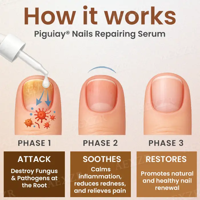 Piguiay® Nails Repairing Serum