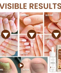 Piguiay® Nails Repairing Serum