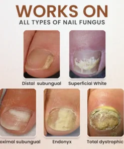 Piguiay® Nails Repairing Serum