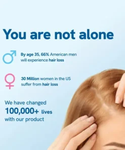 Slimoly™ Professional Anti-Hair Loss Roll-On – Stimulates Hair Growth in 1–2 Weeks