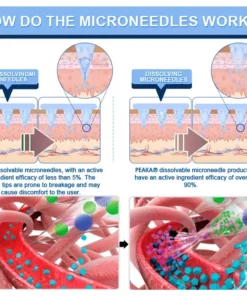 𝐏𝐄𝐀𝐊𝐀® 𝐆𝐋𝐏-𝟏 & 𝐍𝐀𝐃+ Nano Micro Needle Slimming Patch