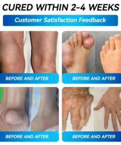 𝐵𝑜𝑠𝑡𝑜𝑟𝑒® 𝐵𝑃𝐶-157 𝐽𝑜𝑖𝑛𝑡 𝑅𝑒𝑠𝑡𝑜𝑟𝑒 𝑂𝑟𝑎𝑙 𝐿𝑖𝑞𝑢𝑖𝑑