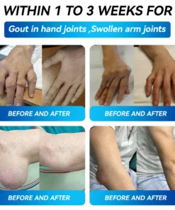 𝐵𝑜𝑠𝑡𝑜𝑟𝑒® 𝐵𝑃𝐶-157 𝐽𝑜𝑖𝑛𝑡 𝑅𝑒𝑠𝑡𝑜𝑟𝑒 𝑂𝑟𝑎𝑙 𝐿𝑖𝑞𝑢𝑖𝑑