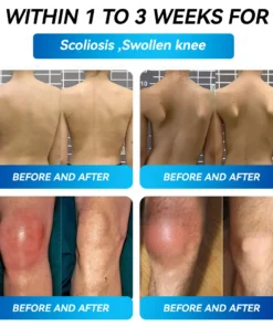 𝐵𝑜𝑠𝑡𝑜𝑟𝑒® 𝐵𝑃𝐶-157 𝐽𝑜𝑖𝑛𝑡 𝑅𝑒𝑠𝑡𝑜𝑟𝑒 𝑂𝑟𝑎𝑙 𝐿𝑖𝑞𝑢𝑖𝑑