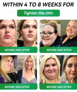 𝑲𝒆𝒚𝒆𝒔𝒔®𝑮𝑳𝑷-1 9-𝒊𝒏-1 𝑯𝒆𝒂𝒍𝒕𝒉 𝑶𝒓𝒂𝒍 𝑳𝒊𝒒𝒖𝒊𝒅 — 𝑰𝒎𝒎𝒖𝒏𝒆 & 𝑫𝒆𝒕𝒐𝒙 𝑺𝒖𝒑𝒑𝒐𝒓𝒕 𝑭𝒐𝒓𝒎𝒖𝒍𝒂