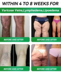 𝑲𝒆𝒚𝒆𝒔𝒔®𝑮𝑳𝑷-1 9-𝒊𝒏-1 𝑯𝒆𝒂𝒍𝒕𝒉 𝑶𝒓𝒂𝒍 𝑳𝒊𝒒𝒖𝒊𝒅 — 𝑰𝒎𝒎𝒖𝒏𝒆 & 𝑫𝒆𝒕𝒐𝒙 𝑺𝒖𝒑𝒑𝒐𝒓𝒕 𝑭𝒐𝒓𝒎𝒖𝒍𝒂