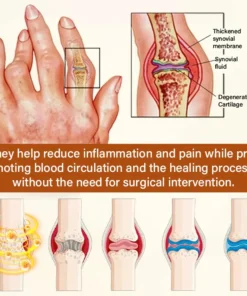 Blizkox® VenomEase Joint Cream