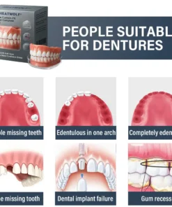 HEATWOLF® Adaptable Custom-Fit Functional Complete Dentures