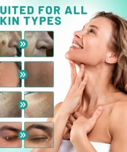 Melax™ 2-in1 Skin Tag Removal Kit