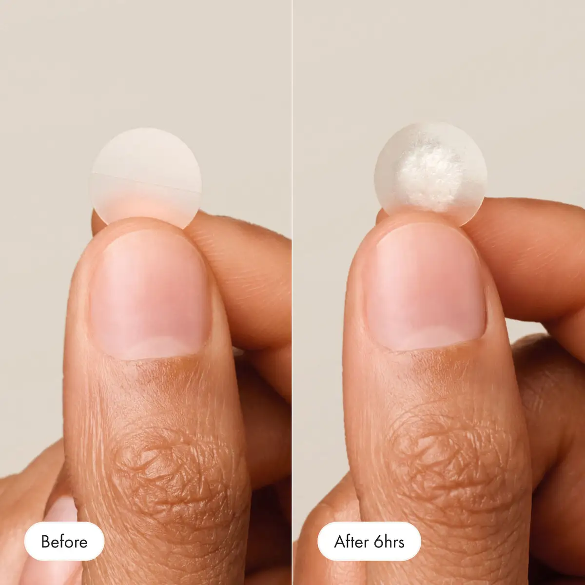 Nexisify™ – Pimple Patch for Clear Skin Overnight (36 Pcs)